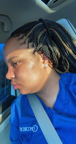 Customer photo review of 3 Pack Turmeric Soap