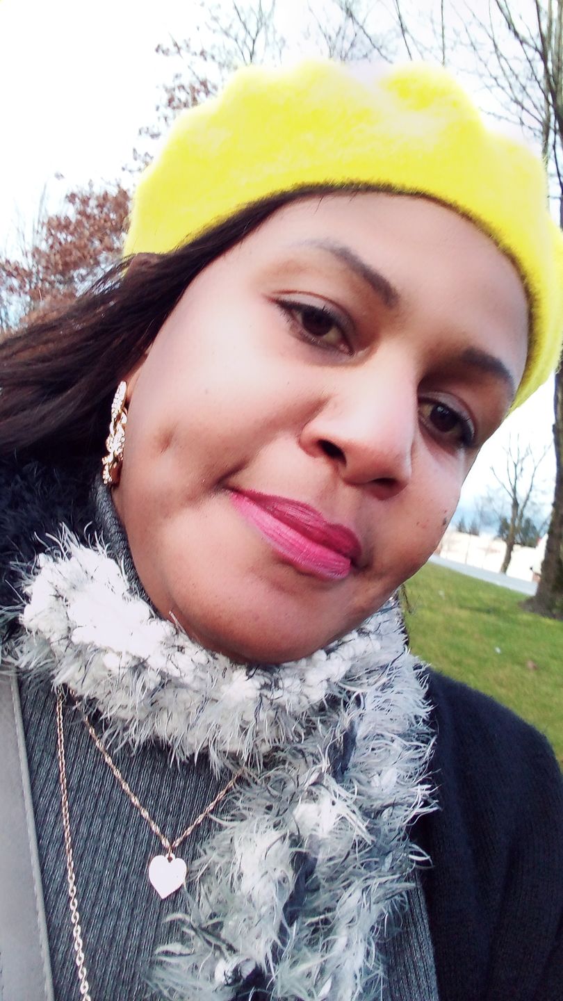 Customer photo review of Organic Extract of Papaya Brightening Gel Tube | 30g | 1Oz