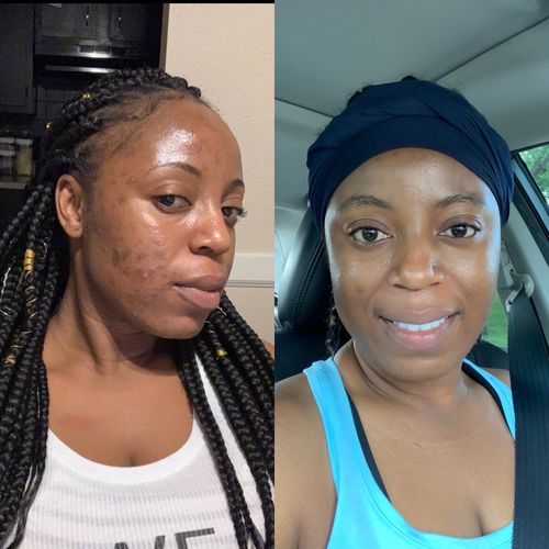 Customer photo review of 3 Pack Turmeric Soap