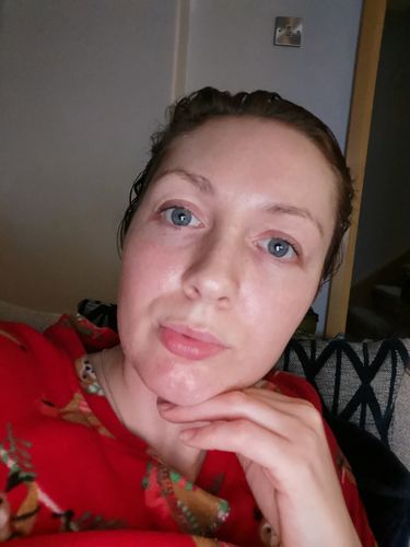 Customer photo review of SkinGlow Electric Cleanser - No More Blackheads