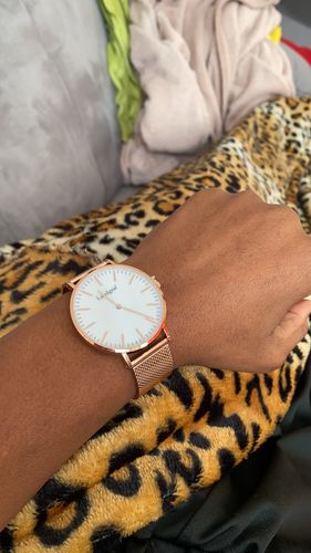 Customer photo review of Shell Dreams Edition Rosé Gold