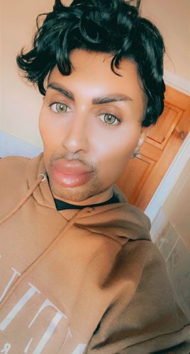 Customer photo review of Norko Green Contact Lenses(12 months wear)