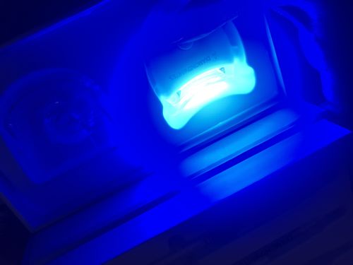 Customer photo review of Teeth Whitening Kit