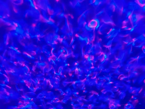 Customer photo review of Yunix Galaxy Projector