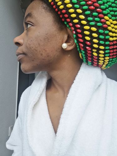 Customer photo review of BLACK SOAP - afrikanische schwarze Seife