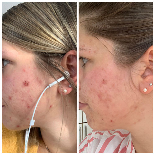 Customer photo review of Cleoglam Hyaluron Creme “The light one” 50ml