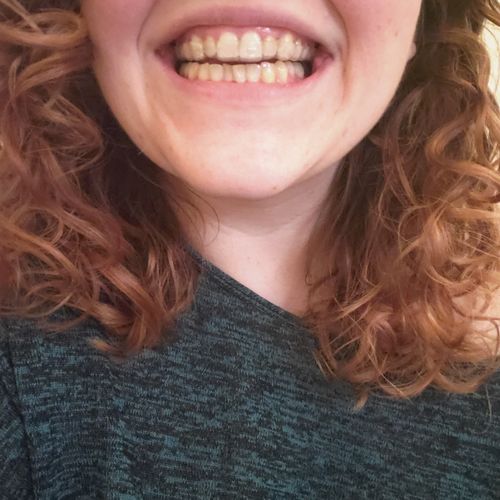 Customer photo review of Night Guard - Yearly