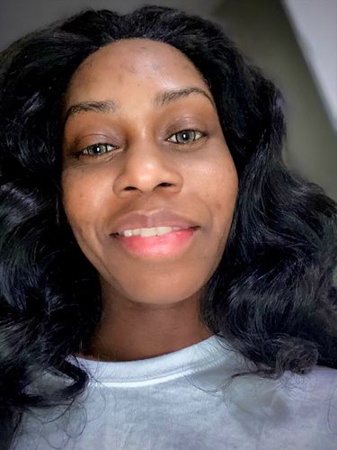 Customer photo review of Norko Brown Contact Lenses(12 months wear)