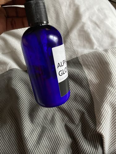 Customer photo review of 2% Alpha Arbutin Glow Lotion
