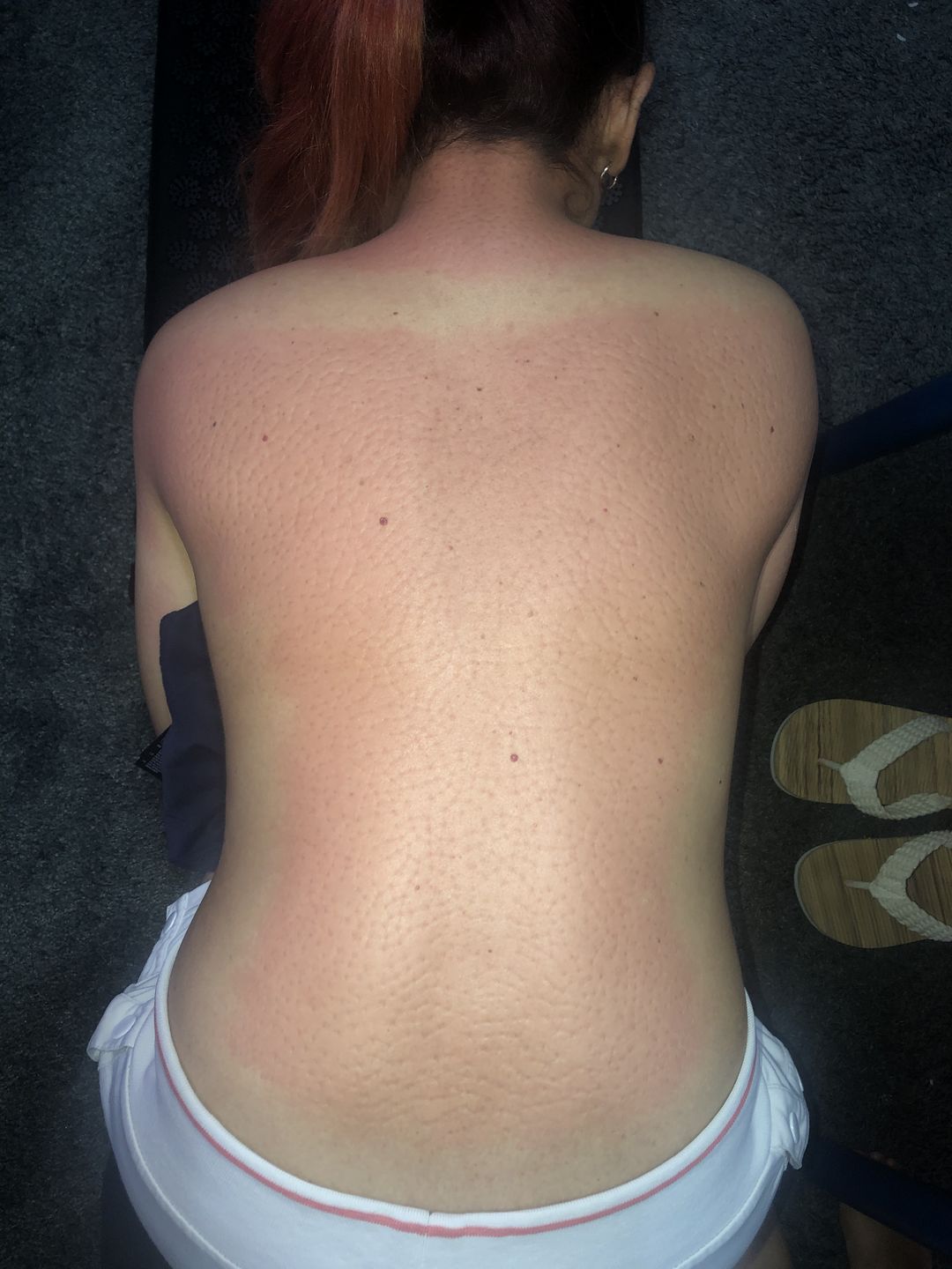 Customer photo review of Acupressure Mat Midnight