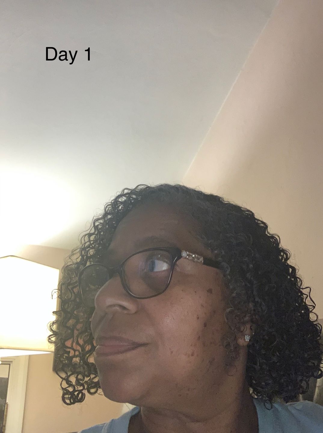 Customer photo review of Moisturizing Cream (12oz)
