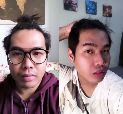 Customer photo review of Serum Concentrate Kit