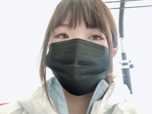 Customer photo review of Vision Hazel Contact Lenses(12 months wear)