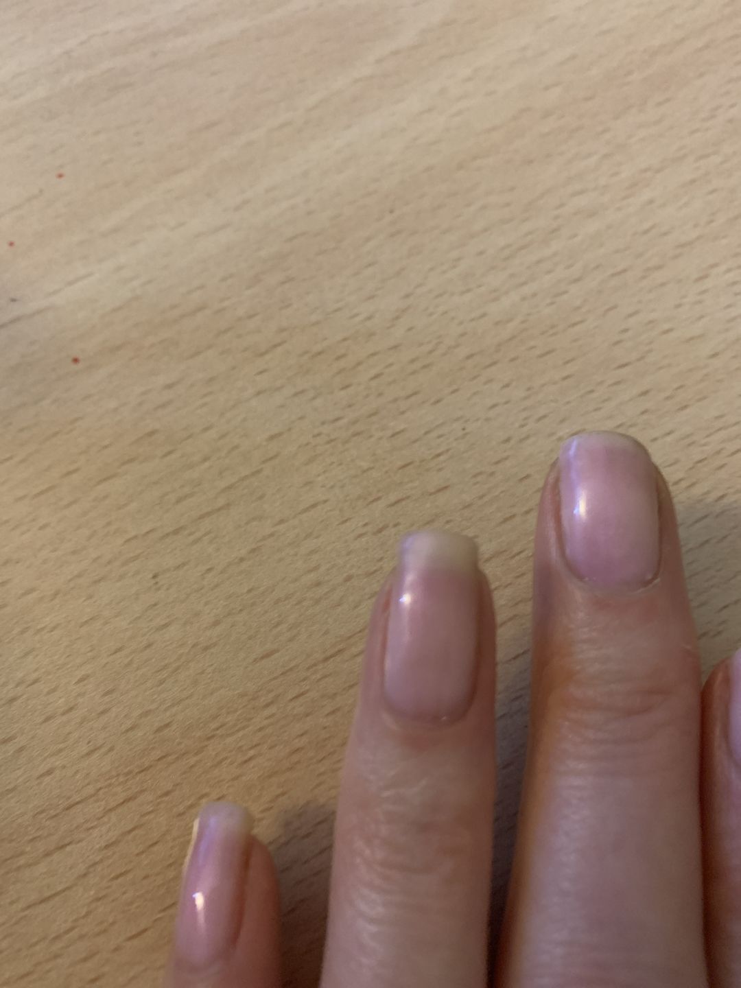 Customer photo review of Semilac Base Coat UV Gel Polish 7 ml