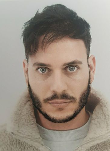 Customer photo review of SL29 Gray Contact Lenses(12 months wear)
