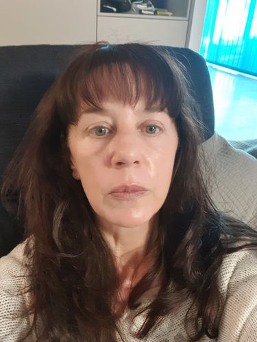 Customer photo review of TriPollar STOP Vx