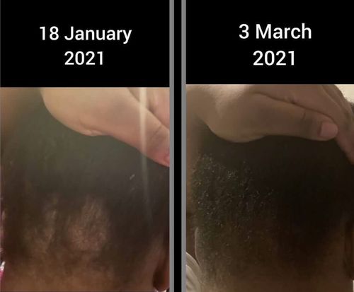 Customer photo review of Inches - Hair & Beard Oil