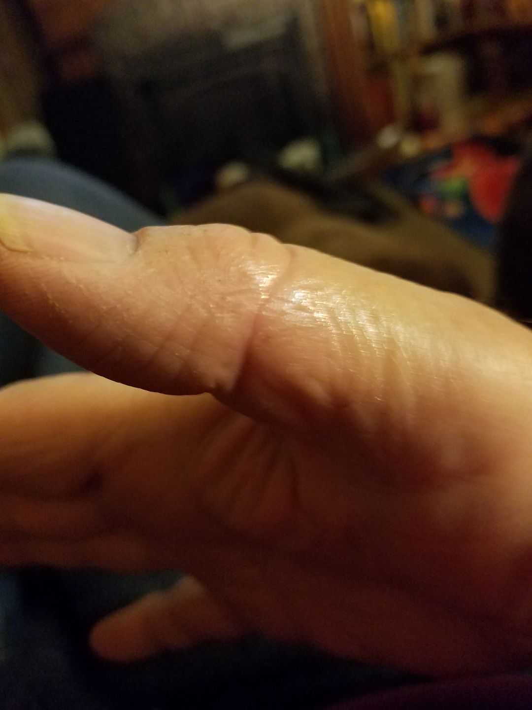 Customer photo review of Combat Ready Ointment - Triple Threat
