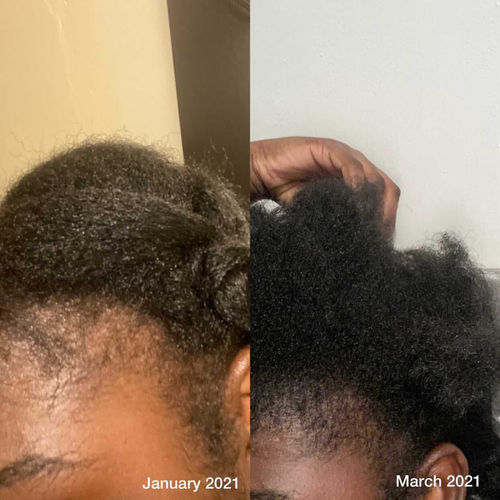 Customer photo review of Genesis