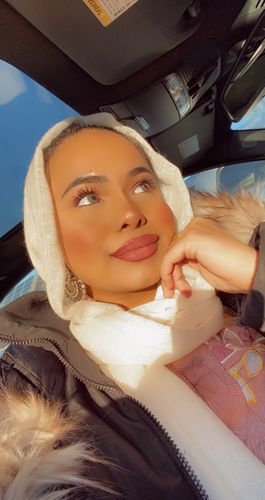 Customer photo review of Neala Brown Contact Lenses(12 months wear)