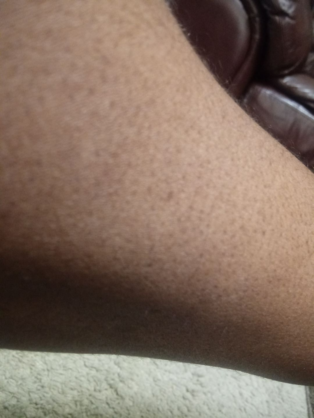 Customer photo review of Fair & White So White Skin Perfector Body Lotion- 500ml / 17.6 oz