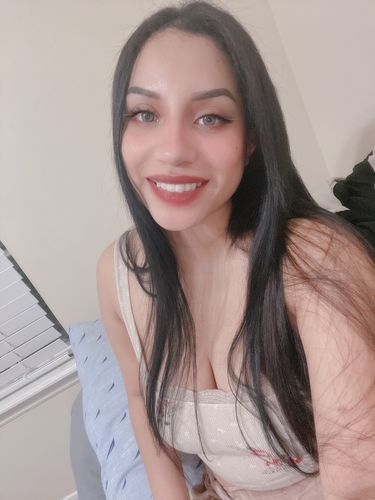 Customer photo review of Neala Green Contact Lenses(12 months wear)