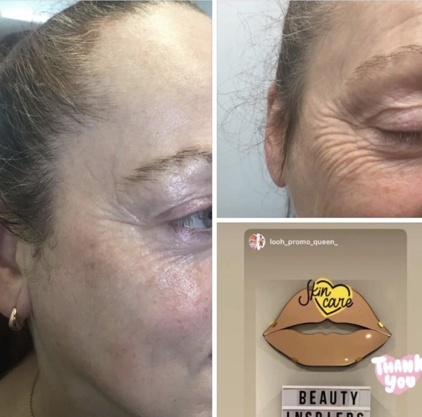 Avaliação com foto de um cliente sobre o DERMISONIC