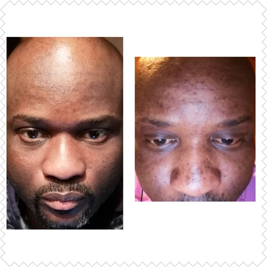 Customer photo review of SHEA SOAP