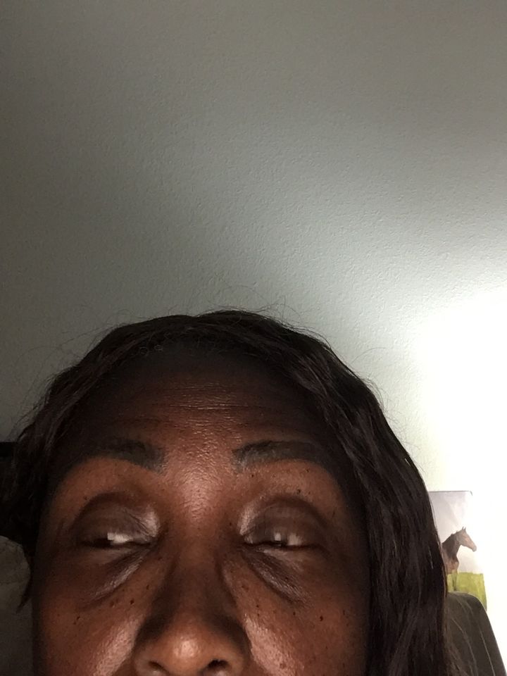 Customer photo review of A-Dream Brightening Eye Cream