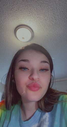 Customer photo review of New York Blue Prescription Contact Lenses