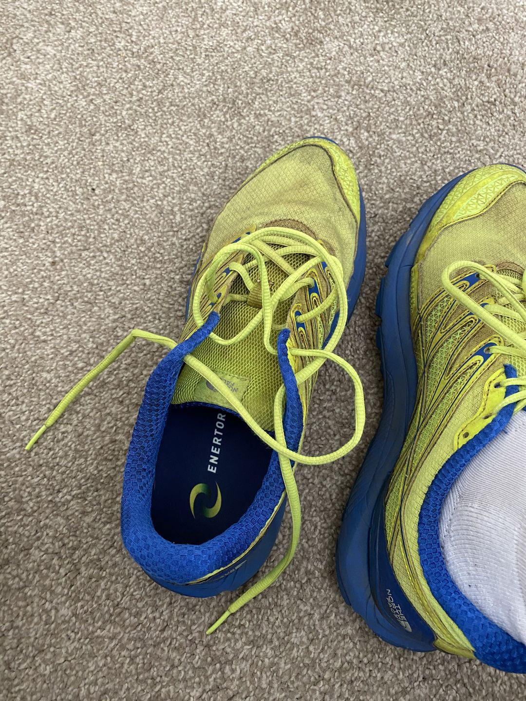Customer photo review of Walking insoles