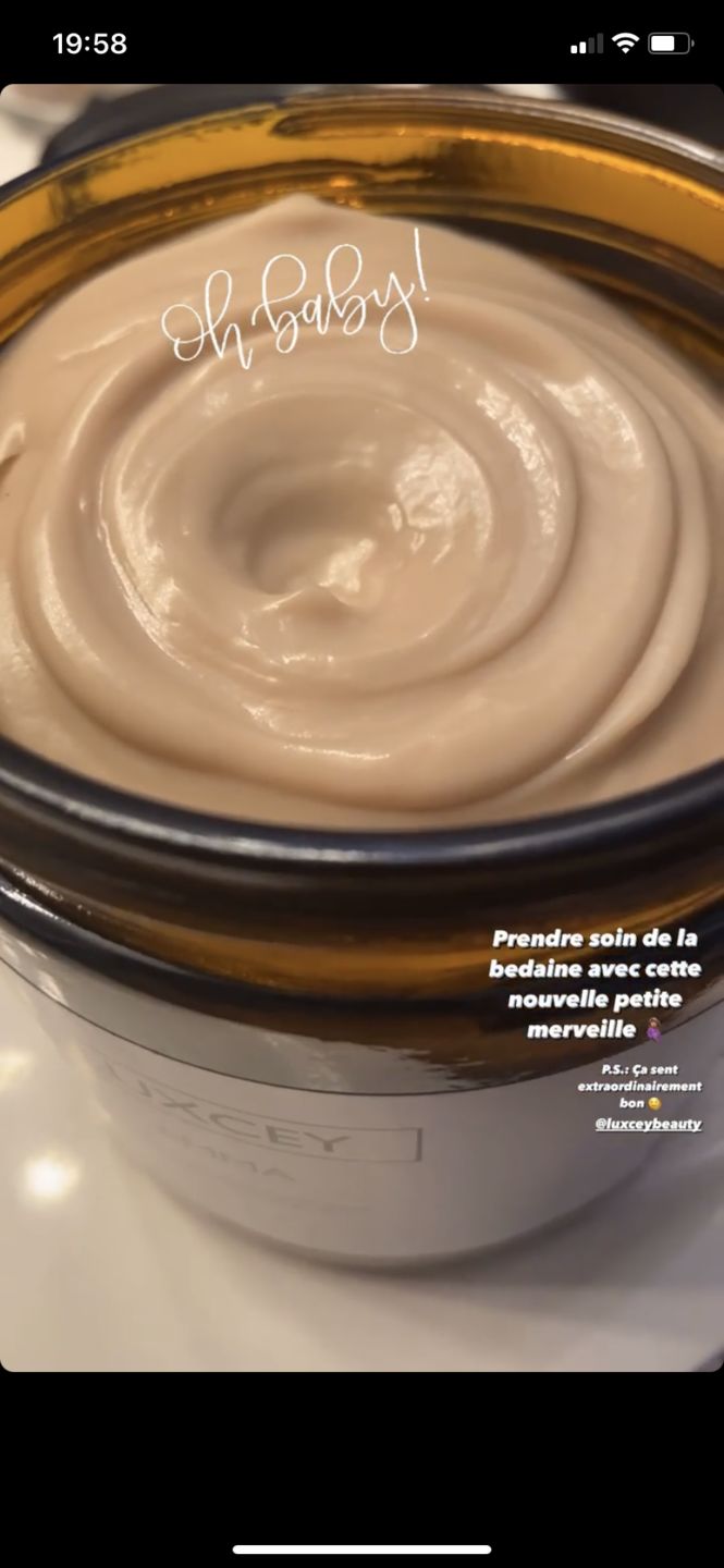 Customer photo review of Emma - Ultra-Moisturizing Body Balm