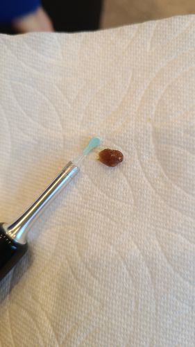 Customer photo review of Bee Gone Wax Ear Cleaner (V-Day Sale)