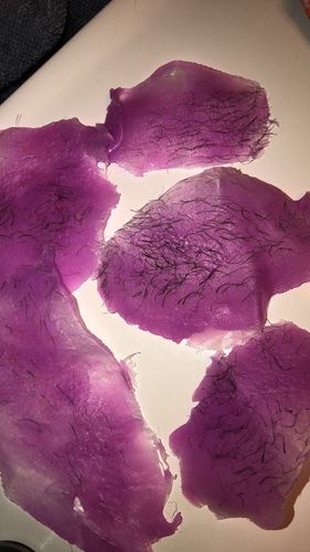 Customer photo review of At-Home Signature Series Hair Removal Wax