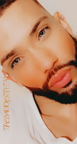 Customer photo review of Salri Brown Contact Lenses(12 months wear)