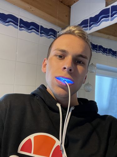 Customer photo review of Phonebleaching® X