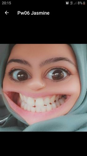 Customer photo review of PAP+ LED Teeth Whitening Kit