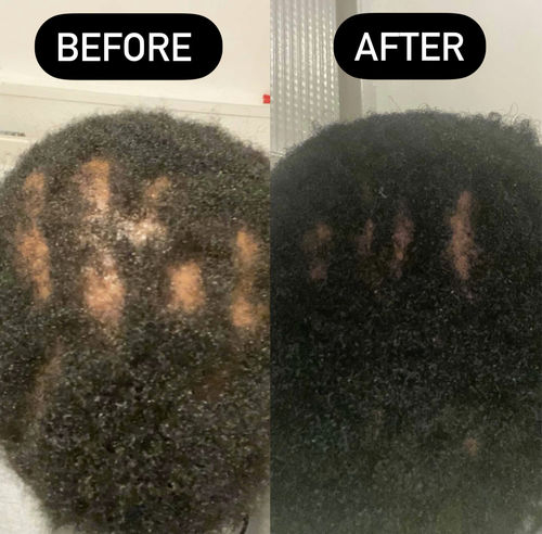 Customer photo review of Inches - Hair & Beard Oil