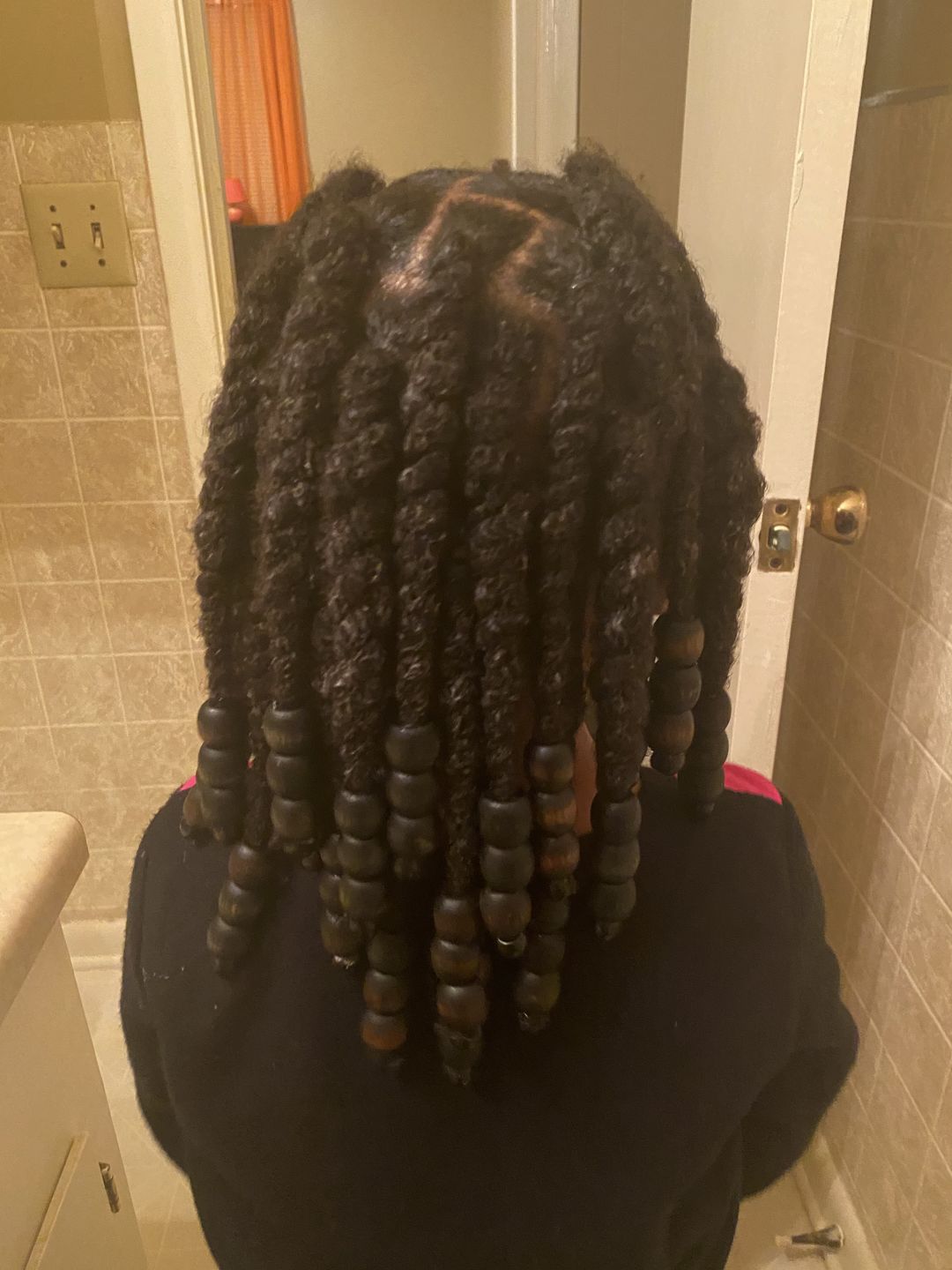 Customer photo review of Moisturizing Cream (12oz)