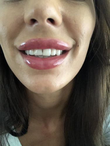 Customer photo review of CocoStrips