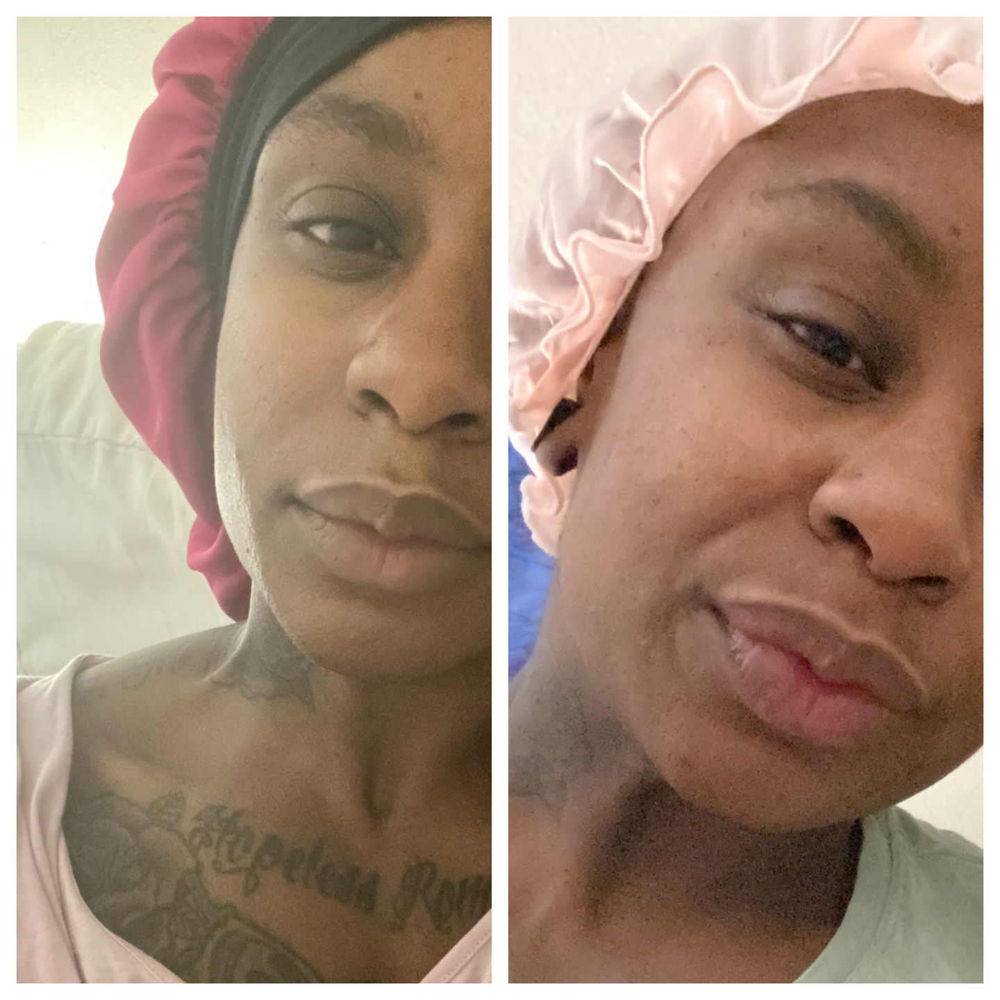 Customer photo review of A-Dream Brightening Eye Cream