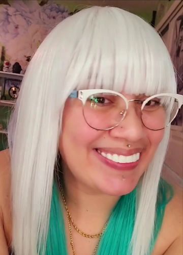 Customer photo review of Pop On Veneers with Impression Kit