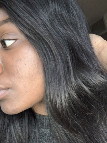 Customer photo review of UR FACIAL CLEANSING BRUSH