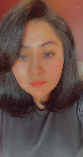 Customer photo review of Gem Blue Contact Lenses(12 months wear)