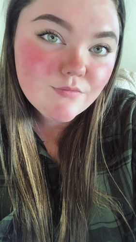 Customer photo review of Hanthy Green Contact Lenses(12 months wear)