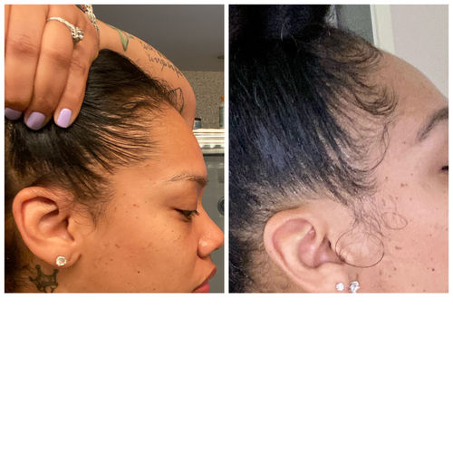 Customer photo review of Chad and India’s Root to Tip Bundle| 3 sizes to choose from