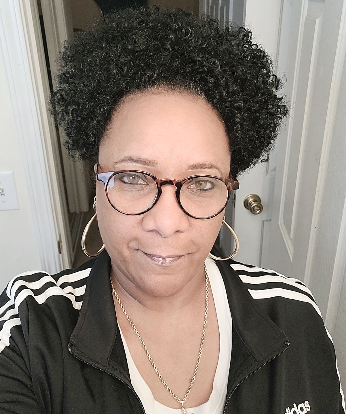 Customer photo review of Lemonvate Brightening Cream 50 gr