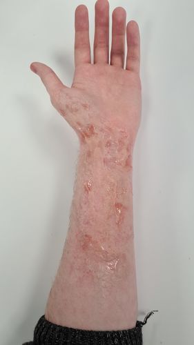 Customer photo review of Maekup Yellow Wound Gel