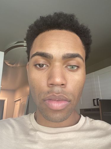 Customer photo review of Alpha Green Contact Lenses(12 months wear)