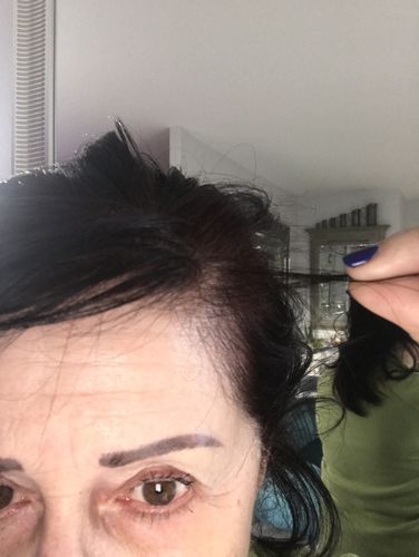 Customer photo review of Good Hair Vitamins - 3 mois